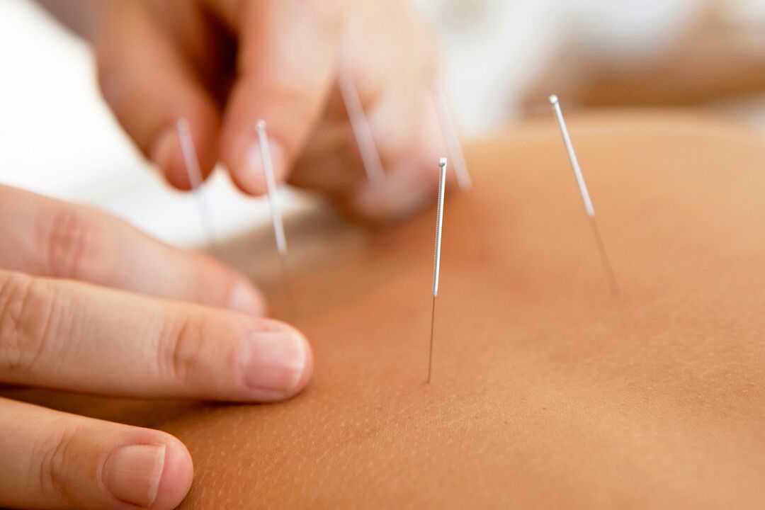 gücünü artırmaq üçün akupunktur