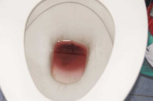 kişilərdə həyəcanlı olduqda ləkələr